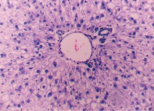 Рис. 12. Выраженная белковая дистрофия <br>гепатоцитов. Группа животных с иммуносупрессией на <br>фоне скармливания минерального адаптоге-на <br>(окраска гематоксилин и эозин, *400)