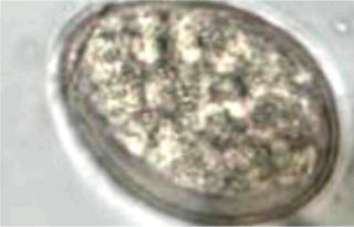 Рис. 12. Яйцо Diphillobothrium latum