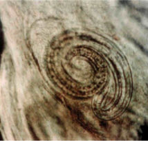 Рис. 18. Личинка Tritchitnella spiralis